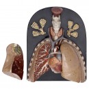 Anatomical Model of the Heart and Lungs, c. 1920